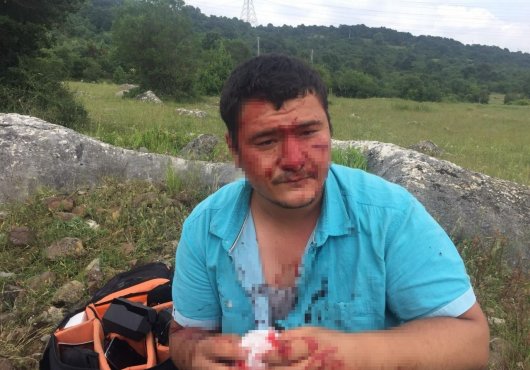 İHA muhabirini darp eden Lütfü Türkkan'a savunma