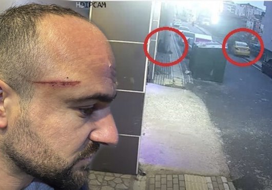 İşe Gitmek Için Otomobiline Bindi, Dehşeti Yaşadı