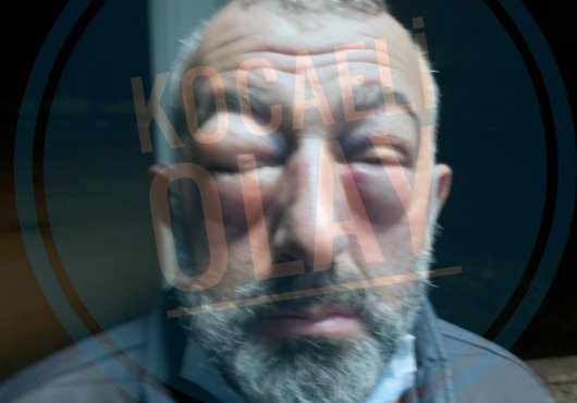 ÖLDÜRESİYE DAYAK YEDİ!